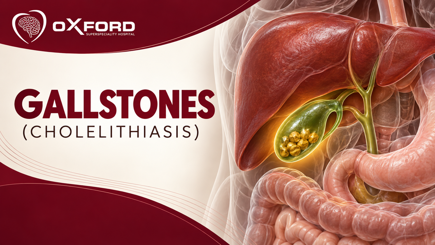 Gallstones (cholelithiasis) — when silent stones need surgery and when they do not
